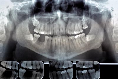 section 1 image